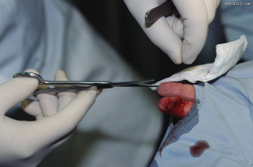 手术台上的医护人员图片大全