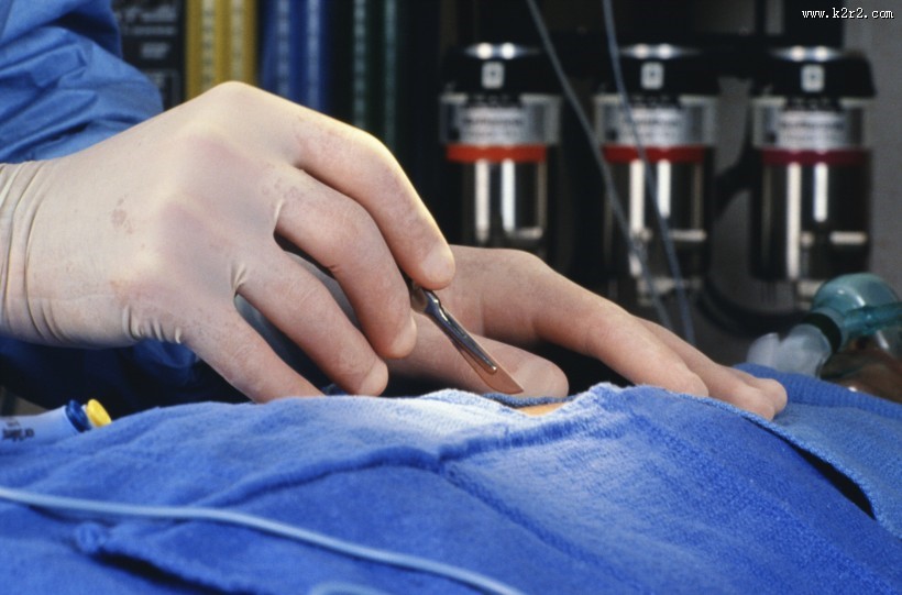 手术台上的医护人员图片大全