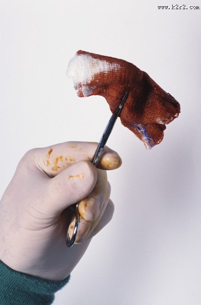 手术台上的医护人员图片大全