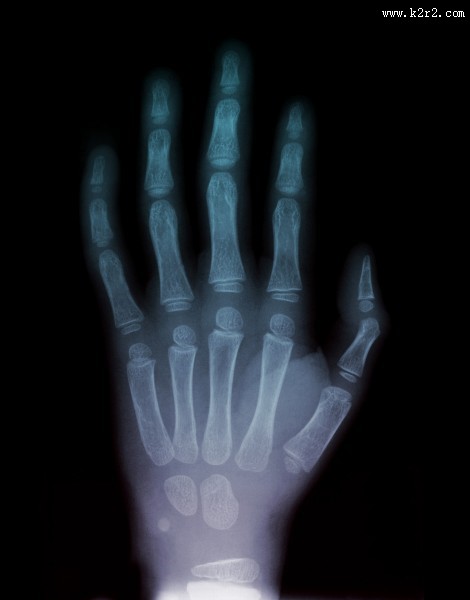 X光下的人物图片大全