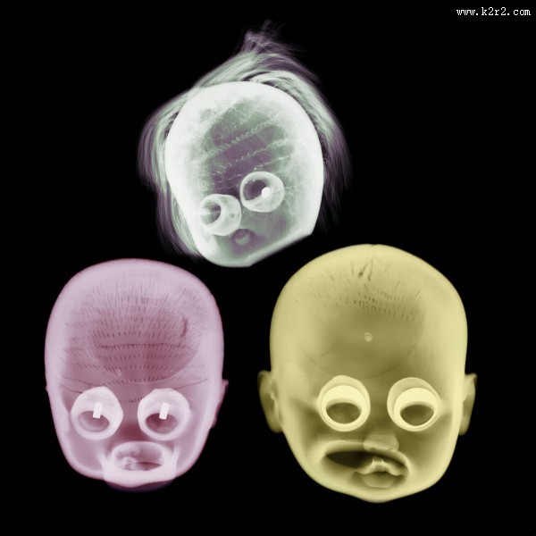 X光下的人物图片大全