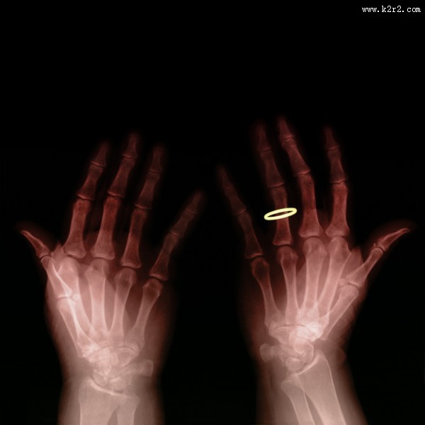 X光下的人物图片大全