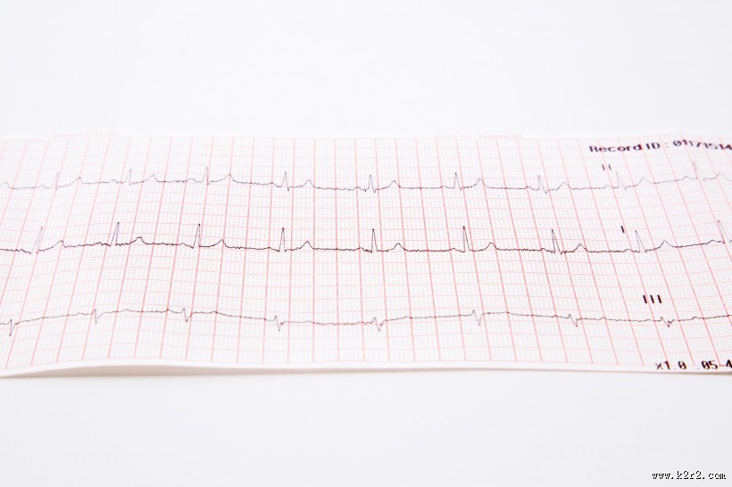 心电图图片大全