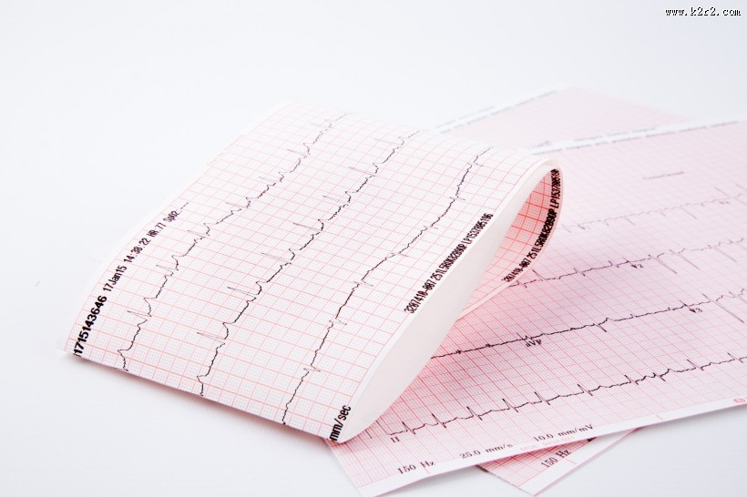 心电图图片大全