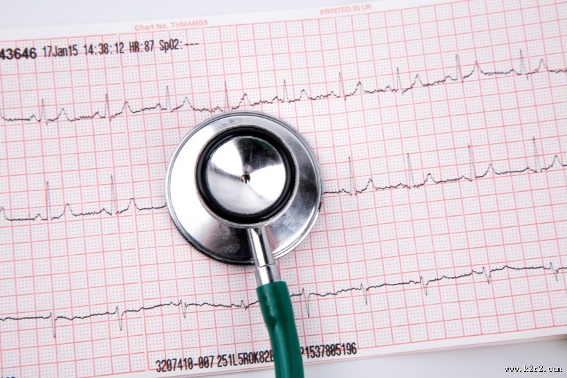 心电图图片大全