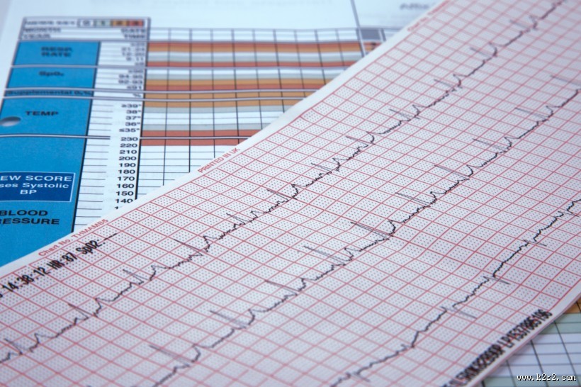 心电图图片大全