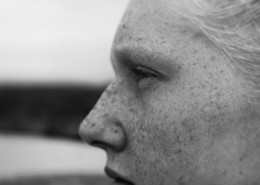 脸上有雀斑的女孩黑白图片