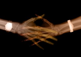 X光下的人物图片大全