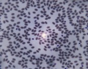 显微镜下的细胞图片