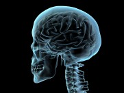 人体x光片图片大全