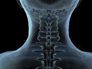 人体x光片图片大全