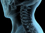 人体x光片图片大全